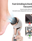 Electronic Foot Files Portable Foot Callus Remover